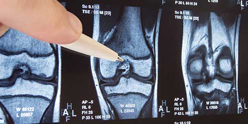 state-of-the-art orthopedic technology